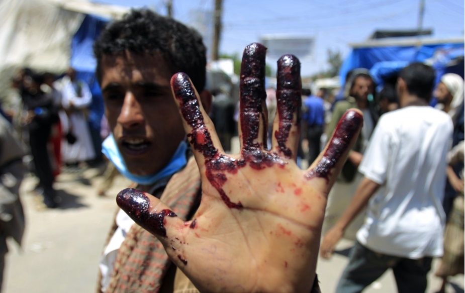 وجدان جهان در یمن چه وقت بیدار می‌شود؟!