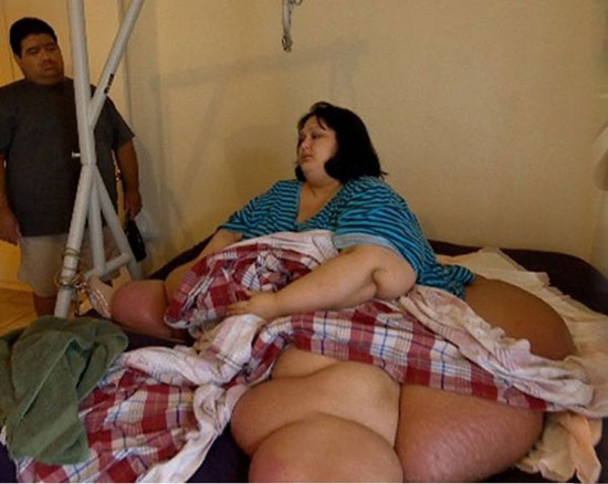 سنگین وزن ترین زن دنیا 300 كيلوگرم وزن کم كرد + تصاویر