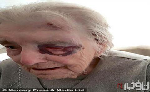 ضرب و شتم یک پیرزن در خانه سالمندان+عکس