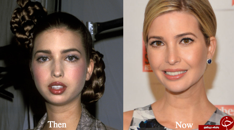 دختر ترامپ قبل و بعد از جراحی زیبایی! +تصاویر