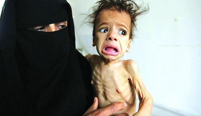 یونیسف : نیم میلیون کودک یمنی درمعرض قحطی