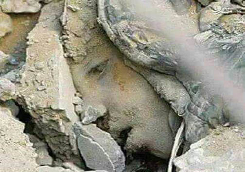 عکس؛ کودکی که زیر بمباران سعودیها، دفن شد