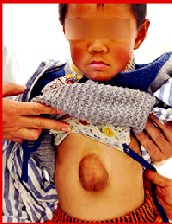 عجیب ترین وضعیت جسمی پسر 5 ساله چینی +عکس