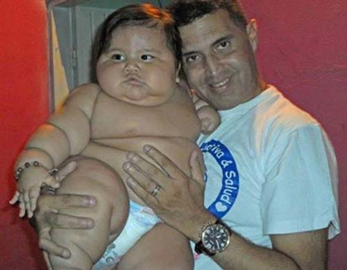 این کودک 20 کیلو وزن دارد
