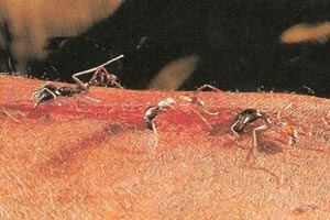 مورچه های حیرت انگیز که جراحی می کنند +عکس