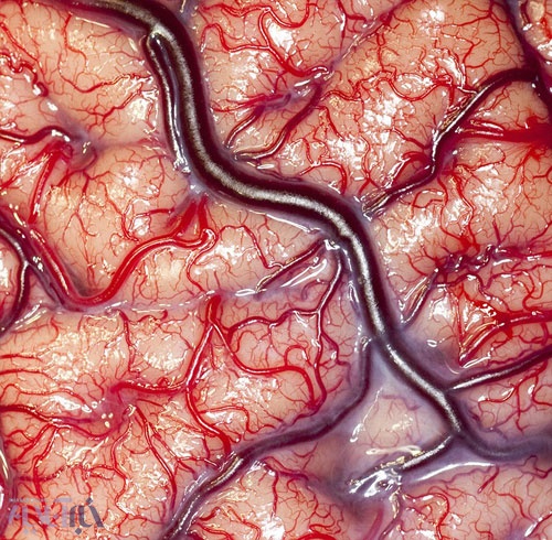 نمای نزدیک از مغز زنده انسان +عکس