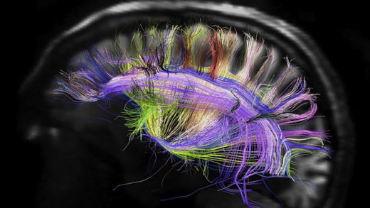 مغز انسان می‌تواند به اندازه کل اینترنت دیتا ذخیره کند