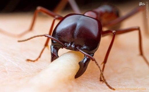 لحظه گاز گرفتن مورچه از انسان + عکس