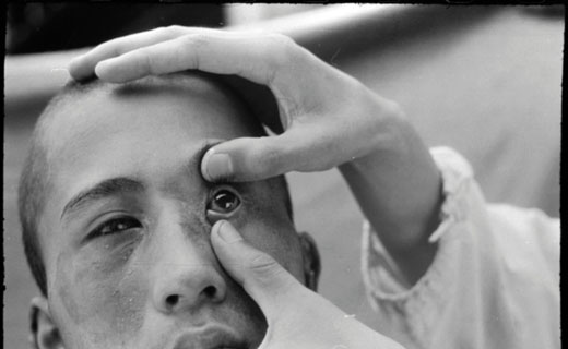 چشم ژاپنی ها بعد از بمباران اتمی هیروشیما +تصاویر