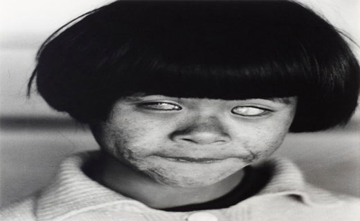 چشم ژاپنی ها بعد از بمباران اتمی هیروشیما +تصاویر