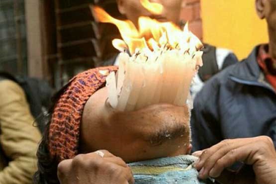 138 مداد و دهها شمع در دهان یک مرد + عکس