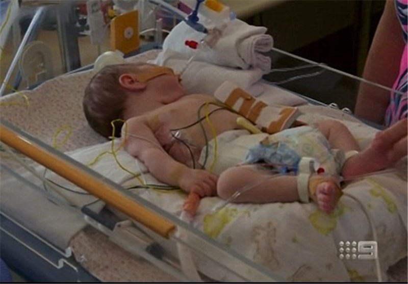 نجات معجزه‌آسای نوزاد ۱۳روزه پس از خارج کردن توده بزرگ + تصاویر