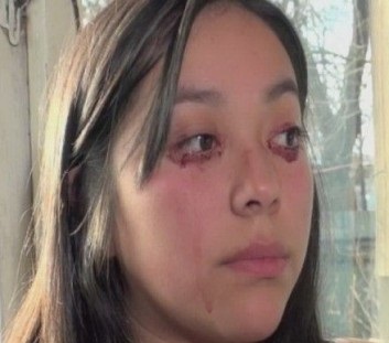 دختری که از چشمانش خون می‌بارد +عکس