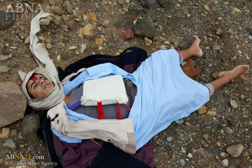 هلاکت یک نوجوان انتحاری نزدیکی دروازه صنعاء + عکس
