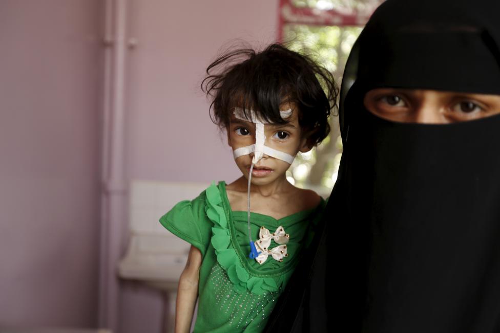 تصاویر/ آثار تکان دهنده سوء‌تغذیه بر کودکان یمنی