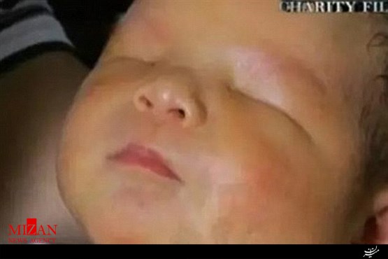 تولد نوزاد بدون چشم مادرش را شوکه کرد (عکس)