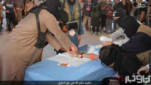 تصاویر دلخراش قطع دست جوان عراقی توسط داعش