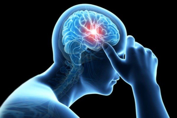 اهمیت تشخیص زودهنگام صرع پایدار برای پیشگیری از آسیب های مغزی