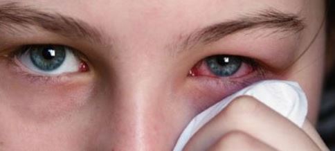 عفونت چشمی را چطور از بین ببریم ؟