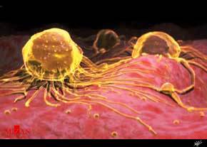 تجویز بی‌رویه رادیولوژی خطر بروز سرطان تیروئید را افزایش می‌دهد