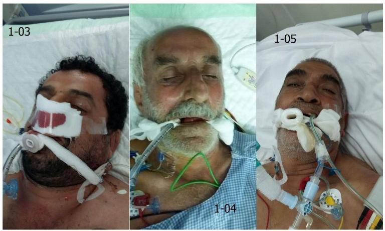 تصاویر 5 نفر از مجروحین ایرانی مجهول الهویه منتشر شد