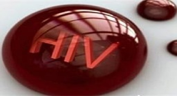 29 هزار و 414 نفر مبتلا به ویروس اچ آی وی در کشور/