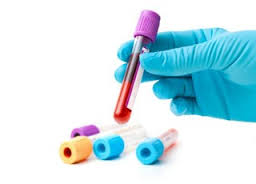 تشخیص نیاز به آنتی‌بیوتیک با آزمایش خون میسر می‌شود