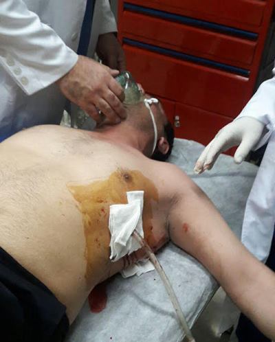 دو شهربان شهرداری با چاقوی قانون شكنان مجروح شدند/ ریه شهاب حسینی چاقو خورد+عكس