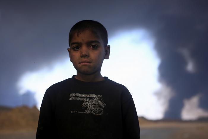 کودک پنج ساله قربانی حملات شیمیایی داعش در القیاره