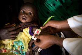 مبارزه برای زنده ماندن از گرسنگی در سومالی