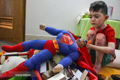 زخم پروانه‌ای روی بال کودک شیرازی
