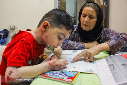 زخم پروانه‌ای روی بال کودک شیرازی
