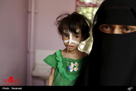 کودکان گرسنه یمن